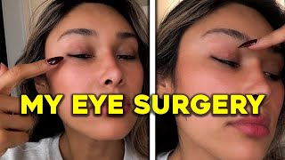 I Got Eye Surgery! What Happened and Why I'm Doing It