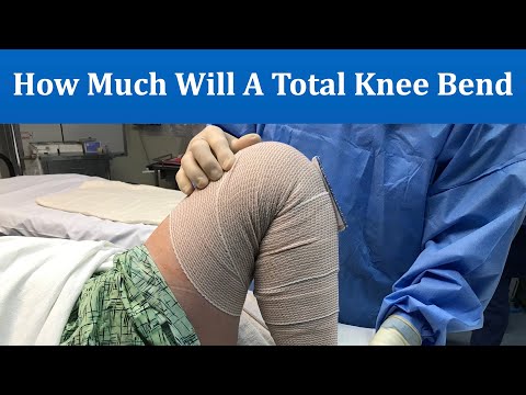 How much will a Total Knee bend? Getting the full range of motion from a knee replacement