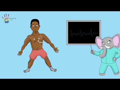 What is an Arrhythmia?