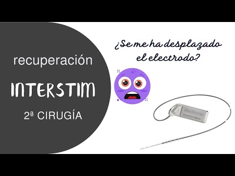 InterStim MICRO, recuperación 2ª cirugía. Actualización marcapasos vesical.