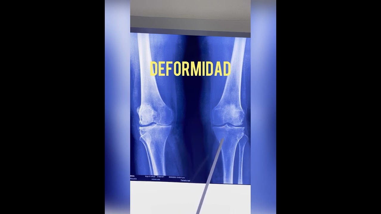 José Emmanuel Vargas Jasso-36