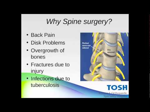 Spine Surgery Treatment for The Treatment Of Back Pain
