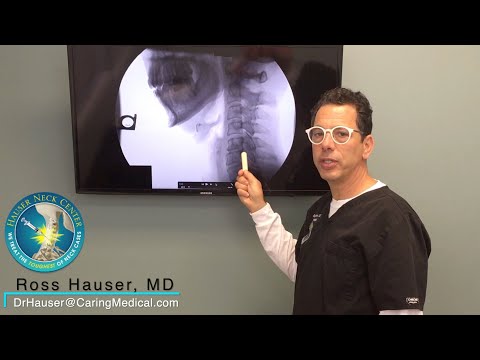 GERD, migraines, fainting, brain fog, and other gradually increasing symptoms in an EDS case