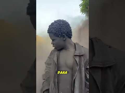 The Boy Who Had Not Bathed for Five Years#shortsfeed