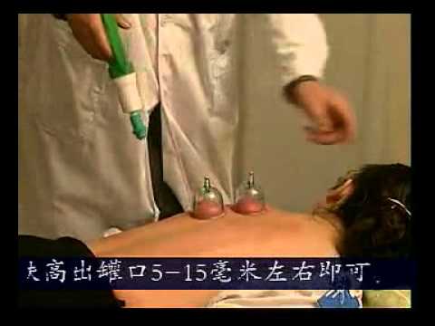Empfehlungen einer Exazerbation der Osteochondrose Symptom pochende Schmerzen im Nacken
