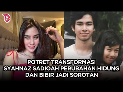 Transformasi Syahnaz Sadiqah, ramai dituding operasi plastik hidung dan bibir | NEWSFLASH