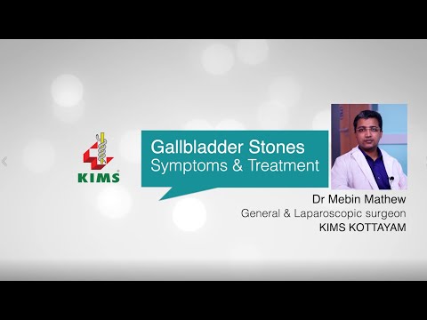 Dr. Mebin Mathew - Gallbladder stones