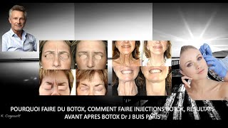 POURQUOI FAIRE DU BOTOX, COMMENT FAIRE INJECTIONS BOTOX, RESULTATS AVANT APRES BOTOX Dr J BUIS PARIS