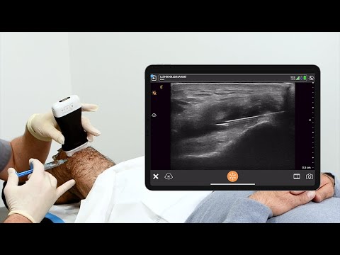 MSK AI and Knee Joint Injection