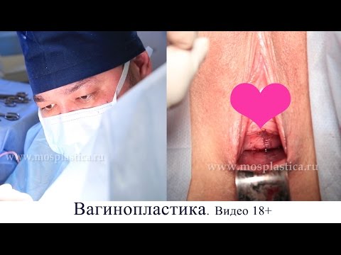 Отзывы Об Интимных Хирургах Отзывы об интимных хирургах