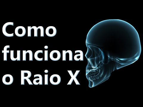 Como funciona o Raio X
