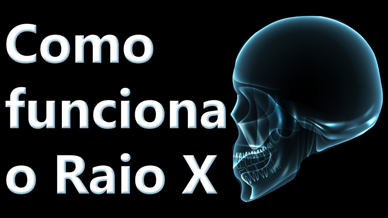 Como funciona o Raio X