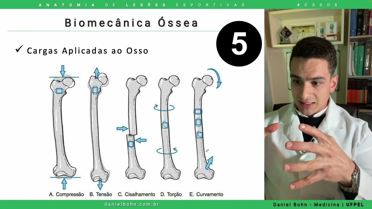 Biomecânica Óssea - Os 5 Tipos de Forças e Traços de Fraturas | Daniel Bohn