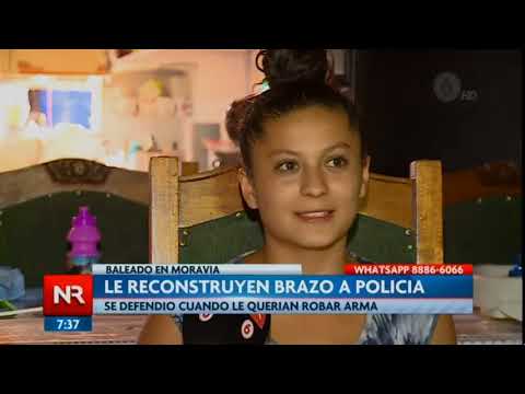 Le reconstruyeron brazo a policía herido en Moravia