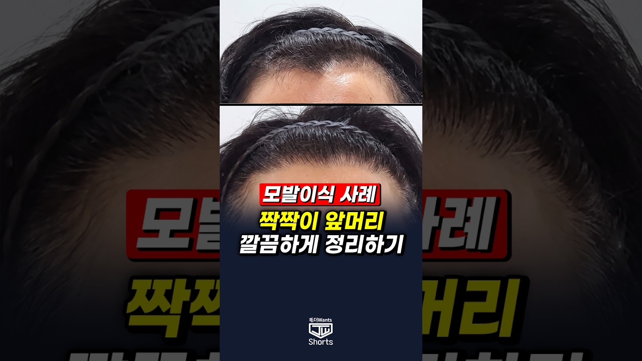 더원츠의원 숏폼