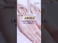 New Clear Scalpceuticals Hair Fall Resist 6s