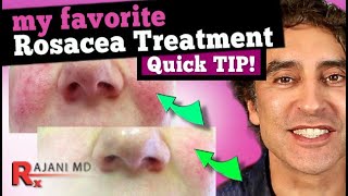 FACE FLUSHING TREATMENT // MY FAVORITE ROSACEA TREATMENT // Rosacea Cure