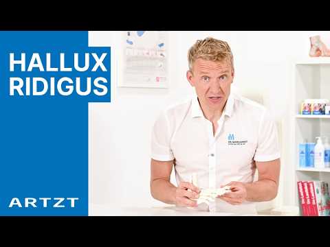 How to treat hallux rigidus | Walk pain-free with Dr. Marquardt | DOCTOR
