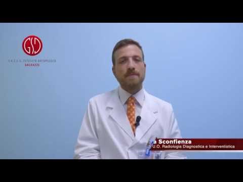 Patologia dellanca negli adulti Pomata per il dolore alla spalla e al collo