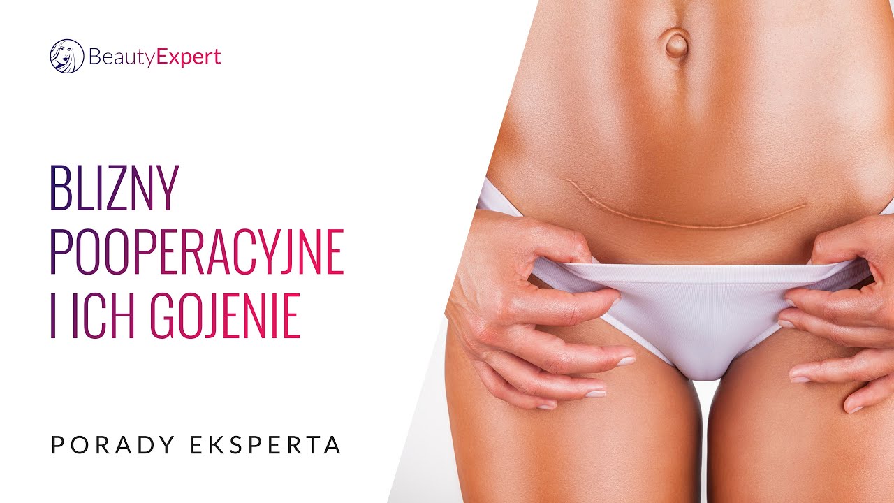 Blizny pooperacyjne i ich gojenie. Porady eksperta