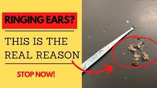 What Cause ringing in the Ear? 5 Most Common Cause | Watch How to Stop  Tinnitus Forever? #tinnitus