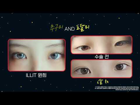 쌍수 한번으로 추구했던 이미지에 도달하다... 🤩