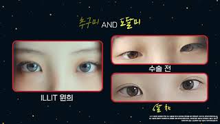 쌍수 한번으로 추구했던 이미지에