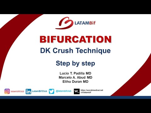 Bifurcations - DK Crush Technique -Step by step