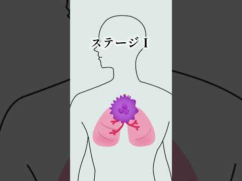 エトルリア医学について詳しく解説