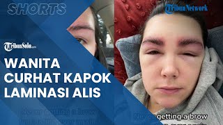 Seorang Wanita Curhat Kapok Lakukan Laminasi Alis, Imbasnya Sulit Buka Mata dan Wajah Bengkak