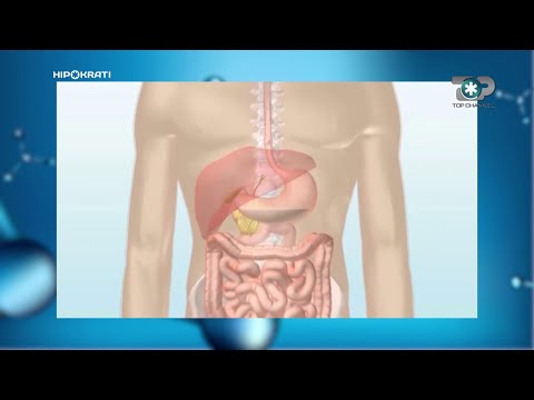 Hipokrati - Kanceri i zorrës së trashë, “Mos i neglizhoni këto shenja”!