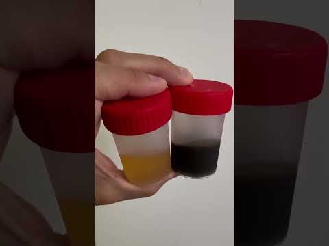 -17 ‘С 🥶 Castrol ON EV Transmission Fluid D1