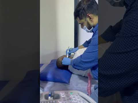 USG Guided FNAC Technique #fnac #shorts #medical