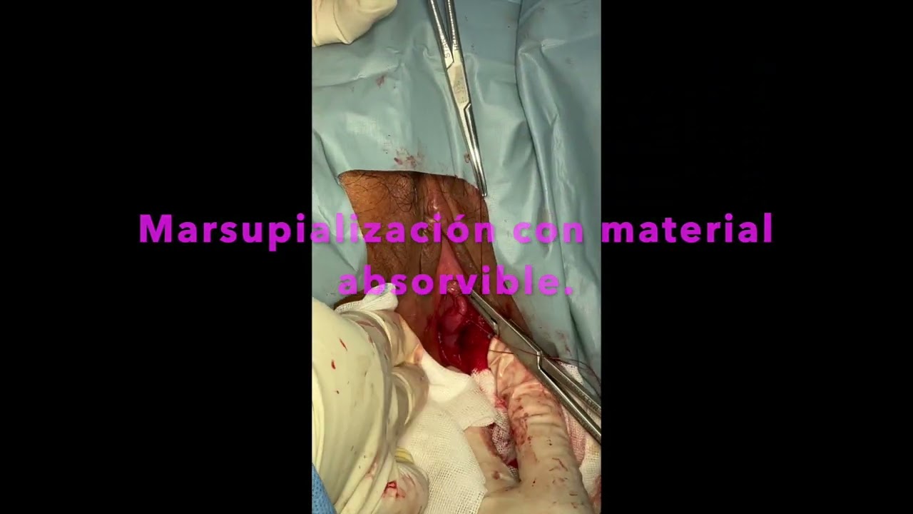 Ángel Millán Juárez-71