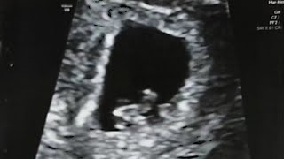 2nd OBGYN Appointment, 6 Week Ultrasound Sneak Peek, and Valley Brew Patio Dining (Stockton, CA)