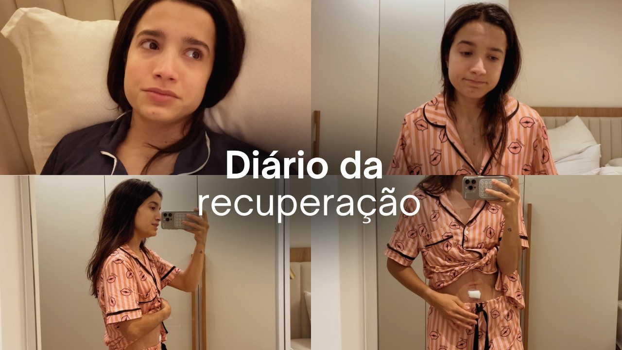 Primeiros dias pós cirurgia: arrependimento, dificuldades e resultado da barriga