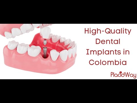 Get Dental Implants in Colombia with Huge Savings Benefit