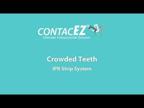 Crowded Teeth   ContacEZ IPR Strip System
