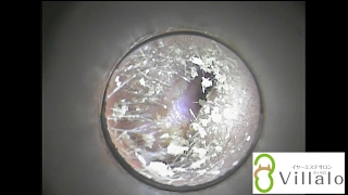 耳掃除動画　vol.２「奥に隠された耳垢」