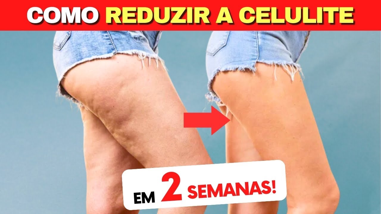 Como REDUZIR A CELULITE em 2 SEMANAS - Naturalmente (Em Casa!)