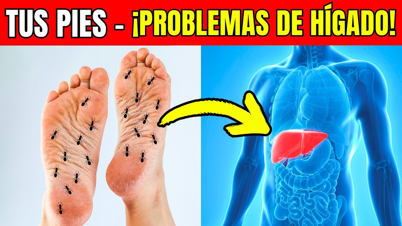 8 SEÑALES que TUS PIES te dan sobre PROBLEMAS HEPÁTICOS. ¡NUNCA IGNORES!