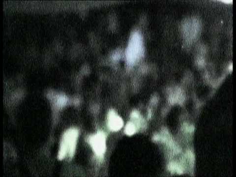 Al Frose-Neboto Nad Skopje