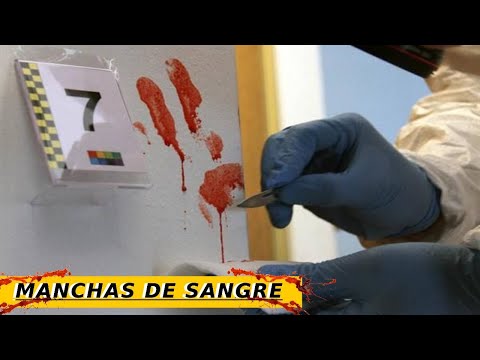 S4nGr3 stain classification | Forensic Hematology