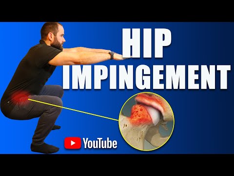 Hip Impingement Pain (FAI) Best Exercises, Rehab & Strengthening (How to Avoid Surgery)