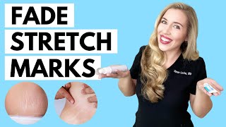 Fade Stretch Marks! | Ingredients that WORK and the Science to Back it up