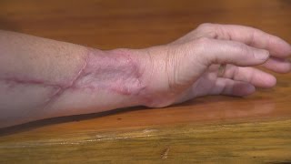 Woman mauled in Plainfield dog attack upset some dogs have been returned