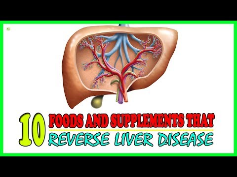 10 Foods And Supplements That Reverse Liver Disease - Fatty Liver Treatment| Best Home Remedies Video