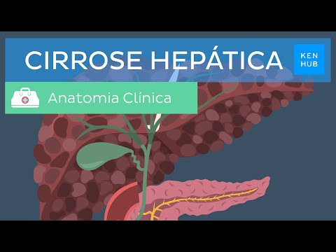 Cirrose hepática: Causas, sintomas, tratamento e prevenção | Kenhub
