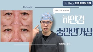 하안검과 중안면거상으로 다시 찾은 자신감