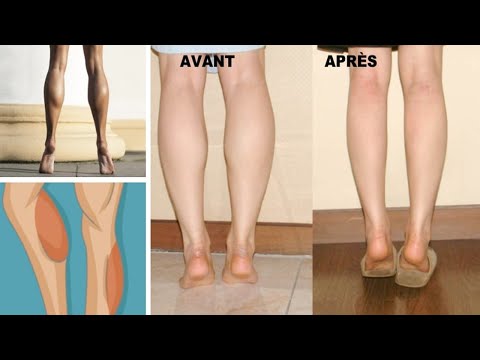 Comment mincir des mollets rapidement ? Comment maigrir des mollets ?